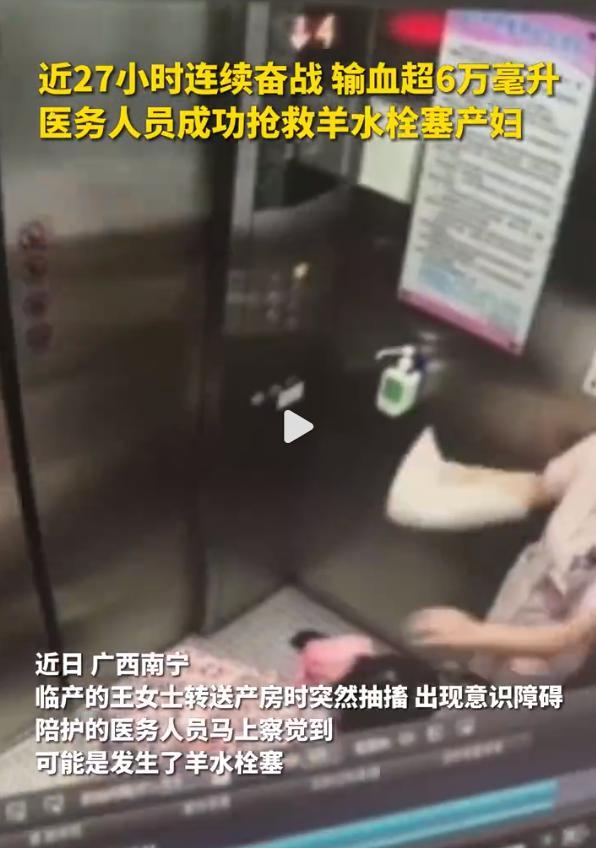 产妇羊水栓塞输血超6万毫升被救 羊水栓塞是什么原因引起的？
